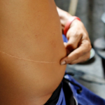 Man arrested for illegally selling wife’s kidney